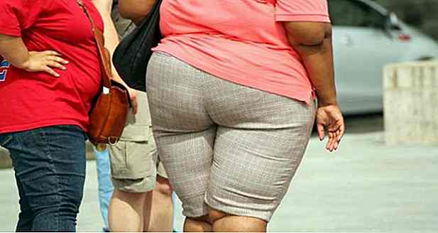 L'obesità moltiplica il rischio di cancro nelle donne di 12 volte