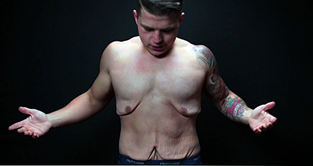 Il video mostra quale enorme perdita di peso causa la pelle