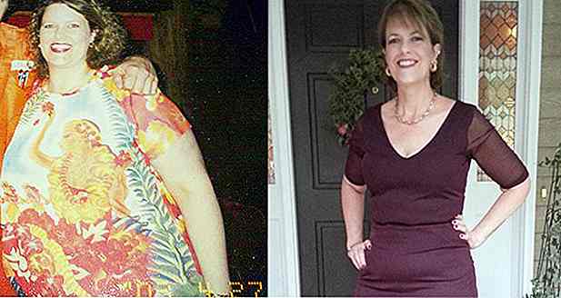 Mujer de 51 años rechaza Cirugía Bariátrica y adelgaza 40 kg por cuenta propia