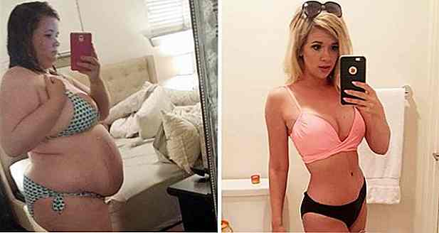 La mujer hace cirugía bariátrica pero sólo logra perder 68 kg con el cambio de hábitos