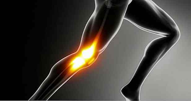 Knie Dislokation - Was es ist, wie man es behandelt, Symptome und was zu tun ist