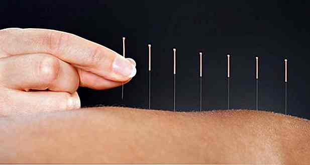 10 benefici dell'agopuntura per fitness e salute