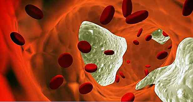 Différences entre le cholestérol LDL et HDL