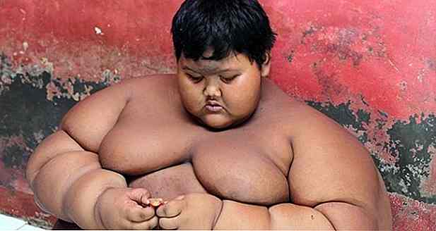 "Le plus gros enfant du monde", un garçon indonésien de 10 ans pèse 192 kg