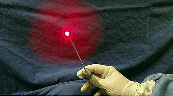 Liposuccion au laser - Comment ça marche et astuces
