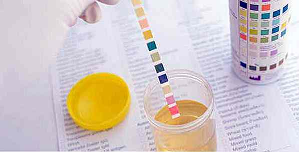 Perte de protéines dans l'urine - Ce que cela signifie